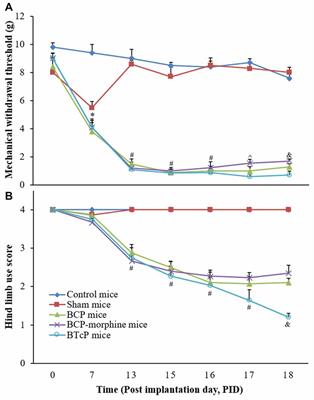 Breakthrough Cancer Pain Is Associated with Spinal Gap Junction Activation via Regulation of Connexin 43 in a Mouse Model